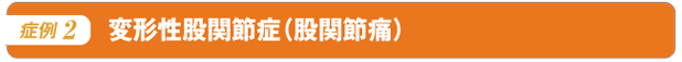 変形性股関節症(股関節痛)